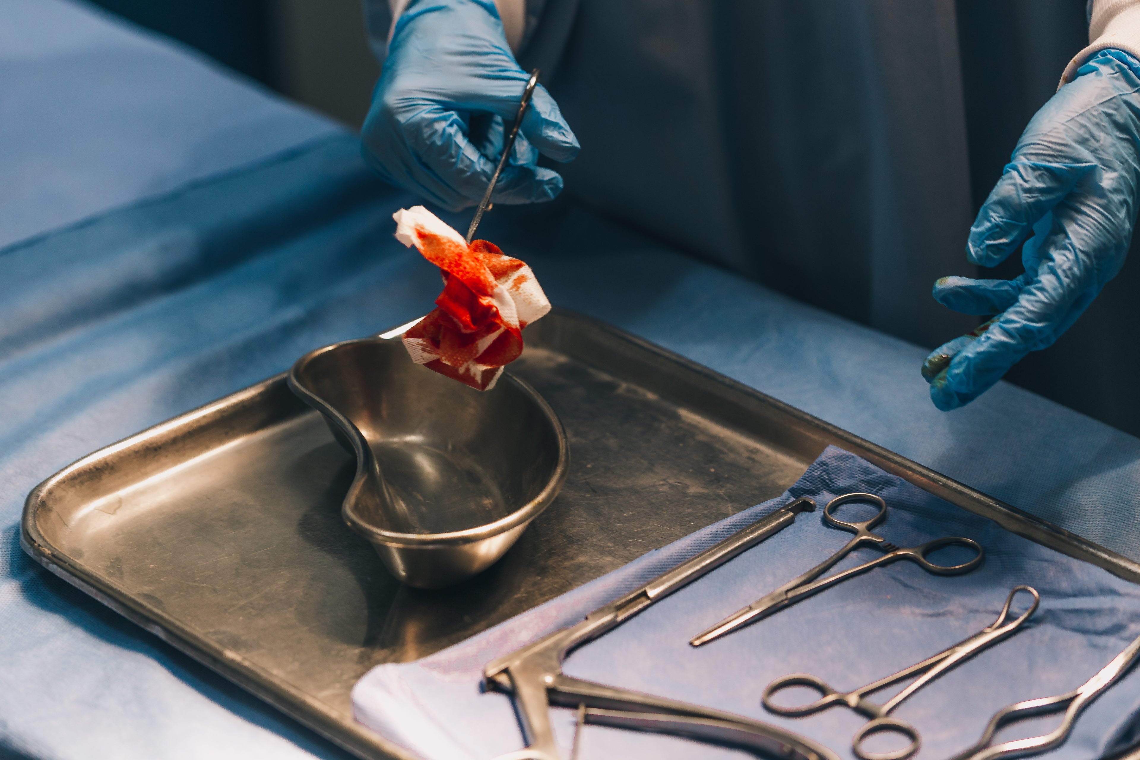 Eine Person mit blauen Einweghandschuhen hält eine chirurgische Pinzette mit blutdurchtränktem Mull über einer Nierenschale aus Metall. Daneben liegen sterile chirurgische Instrumente auf einem blauen Tuch bereit.